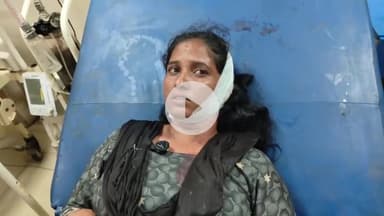 अंबड: नागझरी तालुका अंबड येथे तरुणीस बेदम मारहाण जालण्यातील जिल्हा सामान्य रुग्णालयात उपचार सुरू