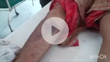 कोल: तारापुर में देवरानी और जेठानी के बीच ब्रा (बनियान) का झगड़ा थाने पहुंचा, जेठानी ने देवरानी पर मारपीट का आरोप लगाया