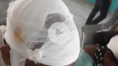 बलिया: शिवनगर दियरा बिंदटोली में जमीनी विवाद को लेकर दो पक्षों में जमकर मारपीट