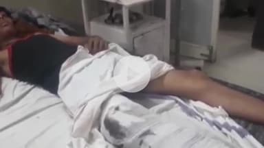 दमोह: नोहटा थाना क्षेत्र में यादव ढाबा के पास फॉर्च्यूनर ने बाइक को मारी टक्कर, एक की मौत, दो घायल