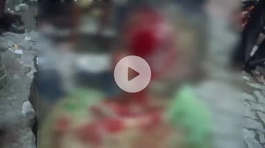 পূব ডিব্ৰুগড়: মহানগৰৰ থানাচাৰিআলিৰ উৰণসেঁতুৰ সমীপত খুজেৰে গৈ থকা অৱস্থাত পিছফালৰ পৰা অচিনাক্ত বাহনে খুন্দিওৱাৰ ফলত গুৰুতৰ ভাৱে আহত এজন