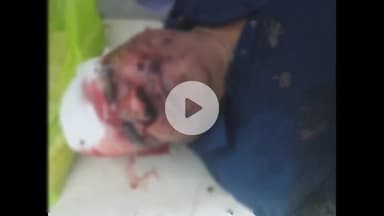 लोहरदगा: जिंगी रोड पर क्रशर प्लांट के पास स्कूटी सवार युवकों ने बाइक को टक्कर मारी, बाइक सवार की मौत, कल होगा पोस्टमार्टम