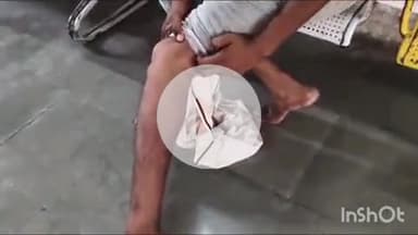 कोल: सैनोल में पुरानी रंजिश के चलते दबंगों ने की मारपीट, घायल ने स्वयं अस्पताल जाकर कराई डॉक्टरी