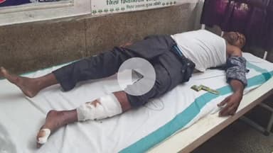 कुटुंबा: अंबा बाजार के हनुमान मंदिर के समीप सड़क किनारे खड़े युवक को अनियंत्रित हाइवा ने मारी टक्कर, रेफर किया गया