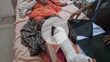 पीपलदा: सुमेर नगर की झोपड़ियों में घर के बाहर चबूतरे पर बैठी महिलाओं को कार ने रौंदा, 4 घायल MBS अस्पताल में भर्ती