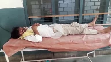 हसनपुर: सैदनगली गांव चमर पतेई में बंदरों के झुंड ने युवक पर किया हमला, युवक की हालत गंभीर