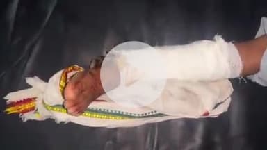 टीकमगढ़: दिनऊ मंदिर के समीप तेज़ रफ़्तार बाइक की टक्कर से 12 वर्षीय बालिका का टूटा पैर, जिला अस्पताल में उपचार जारी