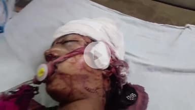 लाडपुरा: कोटा में मोड़ पर ई-रिक्शा पलटा, बालिका नीचे दबने से सिर में आई गंभीर चोट, इमरजेंसी वार्ड में उपचार जारी