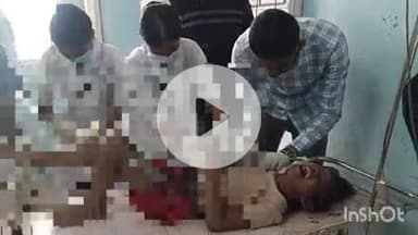 आरा: कतीरा मोड़ के समीप बिजली के संपर्क में आने से 7 साल की बच्ची झुलसी, घायल अवस्था में पुलिस ने अस्पताल में कराया भर्ती