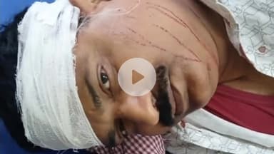 कहरा: सोनवर्षा राज थाना के सहमौरा गांव में स्कार्पियो और ऑटो की टक्कर, दो लोग जख्मी