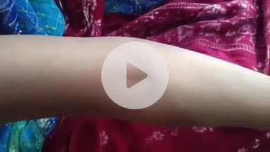 पीपलदा: इटावा कस्बे में बाइपास रोड पर स्थित मकान पर महिला को सांप ने काटा, MBS अस्पताल में भर्ती, उपचार जारी