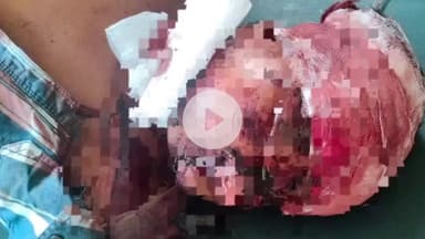 दमोह: हटा के SBN कॉलेज के पास अज्ञात वाहन ने बाइक सवारों को मारी टक्कर, एक की मौत, दूसरा जबलपुर में भर्ती