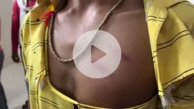 टीकमगढ़: खरोई गांव में दो पक्षों में हुई मारपीट, 7 लोग हुए घायल