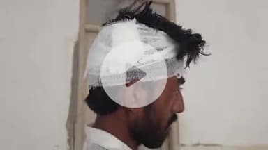 खालवा: छनेरा में भेड़ चराने वाले चरवाहे ने युवक के साथ की मारपीट