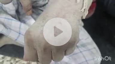 आरा: बहिरो गांव में सांप काटने से बुजुर्ग की हालत बिगड़ी, आरा सदर अस्पताल में कराया गया भर्ती