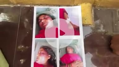 टीकमगढ़: ससुराल पक्ष ने मांगे ₹10 लाख, बेरहमी से की मारपीट, घायल महिला एसपी कार्यालय पहुंची