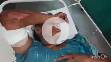 कोल: अकराबाद में बेटी को ससुराल देखने जा रहे बाइक सवार मां-बेटे को अज्ञात वाहन ने रोंदा, गंभीर हालत में अस्पताल में भर्ती