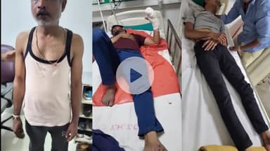 इंदौर: एमआईजी क्षेत्र के एक निजी अस्पताल में बिल को लेकर परिजनों का हंगामा, लोगों से मारपीट