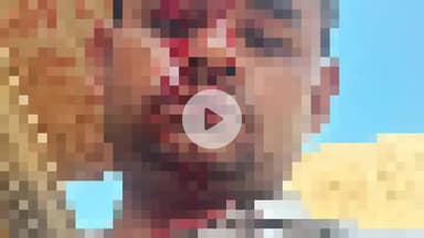 नौगावां सादात: ग्राम प्रधान के घोटाले की शिकायत करना गांव बीलना के युवक को पड़ा भारी, ग्राम प्रधान ने किया जानलेवा हमला