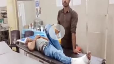 दमोह: लखेरा हार में कार चालक ने गंगाजली पूजन से लौट रहे बाइक सवार को मारी टक्कर, अस्पताल में भर्ती