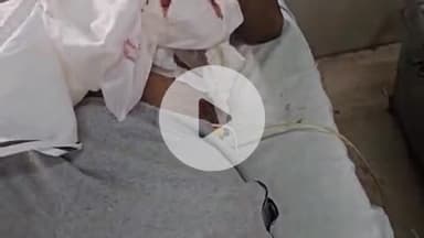 लाडपुरा: नयापुरा इलाके के ब्रजपुरा में देर रात युवक को चाकू मारा गया, एमबीएस अस्पताल में भर्ती, उपचार जारी