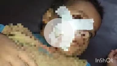 बहराइच: गलकारा गांव में घर के बाहर खेल रहे बालक पर कुत्ते ने किया हमला, हालत गंभीर