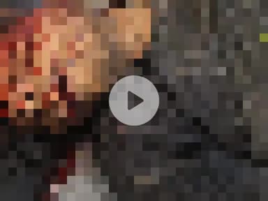 नौगावां सादात: नौगांवा अमरोहा रोड पर पेट्रोल पंप के पास बाइक फिसलने से बाइक सवार घायल, हालत गंभीर