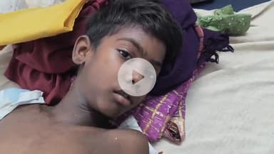 लोहरदगा: कसियाडीह में आम तोड़ने के दौरान पेड़ से गिरा बालक, गंभीर रूप से घायल