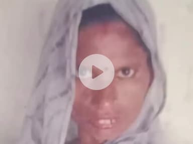 बिल्हौर: ककवन के हालामऊ गांव में ससुर की 13वीं से पहले बहू की सांप काटने से हुई मौत