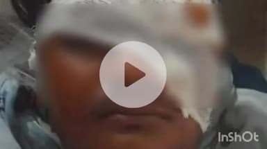 नानपारा: मंगलपुरवा बाईपास के पास अज्ञात चार पहिया वाहन की टक्कर से दो लोग हुए घायल, अस्पताल में इलाज जारी