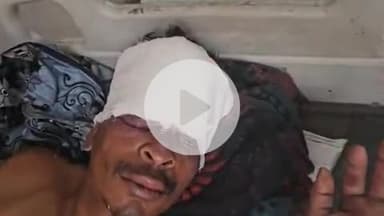 लाडपुरा: बिजौलिया क्षेत्र में 2 मोटरसाइकिलों की भिड़ंत में 2 लोग घायल, एमबीएस अस्पताल में भर्ती, उपचार जारी