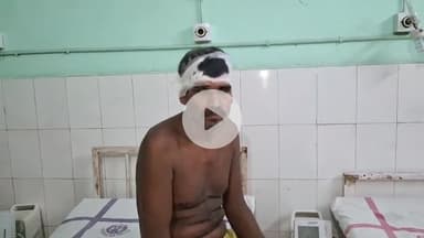 महनार: लावापुर महनार पंचायत के वार्ड 13 में ताड़ का फल काटने को लेकर  हुआ विवाद, एक व्यक्ति जख्मी