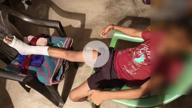 लोहरदगा: होंदगा गांव के स्कूल में छत से कूदने के दौरान दो बालक गंभीर रूप से घायल