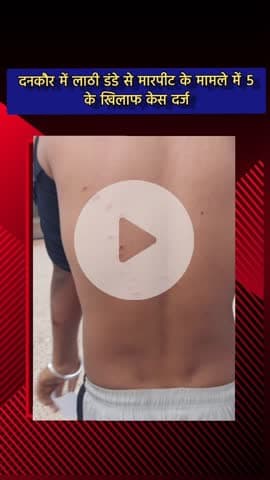 जेवर: दनकौर में लाठी-डंडों से हुई मारपीट के बाद 5 लोगों के खिलाफ दर्ज हुआ केस