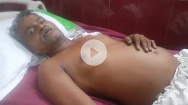 रामपुर: युसूफनगर गांव के जंगल में सांड के हमले से एक व्यक्ति हुआ घायल, जिला अस्पताल में भर्ती