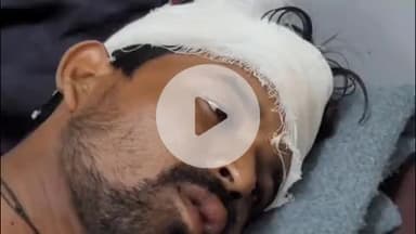 खालवा: सुतार खेड़ा में युवक पर गिरा पेड़, युवक गंभीर रूप से घायल