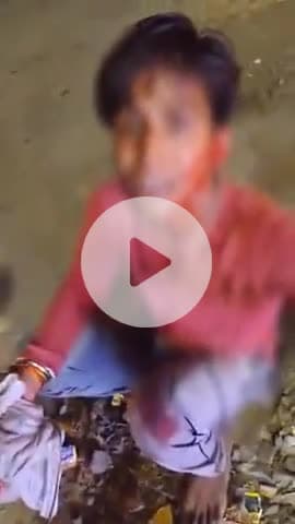 कानपुर: हनुमंत विहार में दबंगों ने युवक को पीट-पीट कर लहूलुहान किया, आई गंभीर चोट