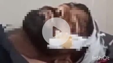 नानपारा: रिसिया कस्बे के पास 10 वर्षीय बच्ची से टकराया बाइक सवार, दोनों का इलाज जारी