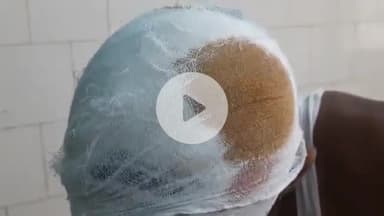 बलिया: मकसूदपुर में घरेलू विवाद में युवक के साथ मारपीट, सिर फोड़ा