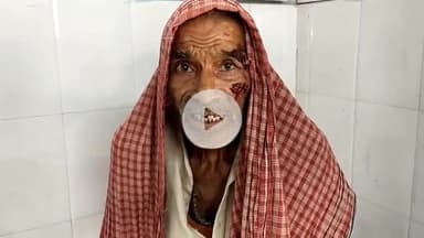 पूसा: माली नगर ठहरा गांव में कुत्ते ने एक बुजुर्ग व्यक्ति को काटा, पूसा अस्पताल में कराया गया भर्ती