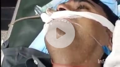 भभुआ: भूपेश गुप्त कॉलेज के पास 13 जून को सड़क दुर्घटना में घायल सदर अस्पताल के गार्ड का वाराणसी में इलाज के दौरान निधन