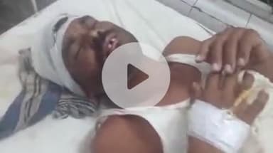 बारां: बजरंगगढ़ गांव में अज्ञात लोगों ने धारदार हथियारों से हमला कर एक व्यक्ति को किया घायल, जिला अस्पताल में कराया गया भर्ती