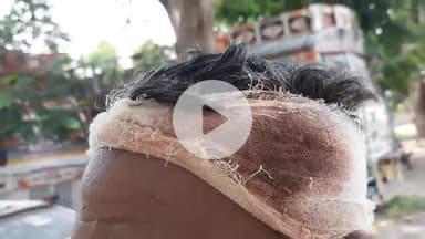 साहेबपुर कमाल: साहेबपुरकमाल वार्ड 12 में एक व्यक्ति के साथ मारपीट, सिर फोड़ा