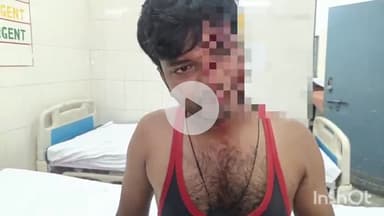 बरेली: सीबीगंज थाना क्षेत्र के महेशपुर के रहने वाले युवक को उसके बड़े भाई ने पीटकर किया घायल, पुलिस से की शिकायत