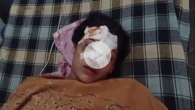 हसनपुर: रहरा के गांव शकरगडी के पास पुराने विवाद के चलते बाइक सवार दंपति पर किया हमला, महिला की हालत गंभीर