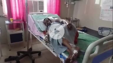 अमरोहा: मुरादाबादी गेट इलाके में चार्जिंग के दौरान बैटरी फटने से घर में लगी भीषण आग, तीन लोग झुलसे अस्पताल में भर्ती