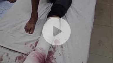 दीगोद: बडौद काली सिंध नदी की पुलिया पर मोटरसाइकिल डिवाइडर से टकराने से अधेड़ घायल, एमबीएस अस्पताल में भर्ती