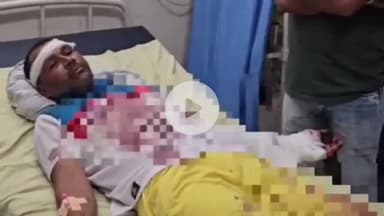 करनाल: गांव कुटेल में पुरानी रंजिश के चलते रविंद्र पर हमला, अस्पताल में भर्ती