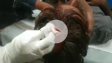 हमीरगढ़: सियार में मामूली विवाद के चलते रिश्तेदारों ने एक व्यक्ति पर धारदार हथियार से किया हमला, जिला अस्पताल में इलाज जारी