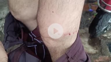 लाडपुरा: कोटा के दादाबाड़ी थाना क्षेत्र में चाकू की नोक पर बुजुर्ग से लूट, बदमाशों ने मारपीट कर सोने की चेन व स्कूटी लूटी